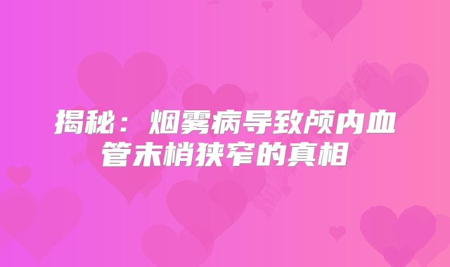 揭秘：烟雾病导致颅内血管末梢狭窄的真相