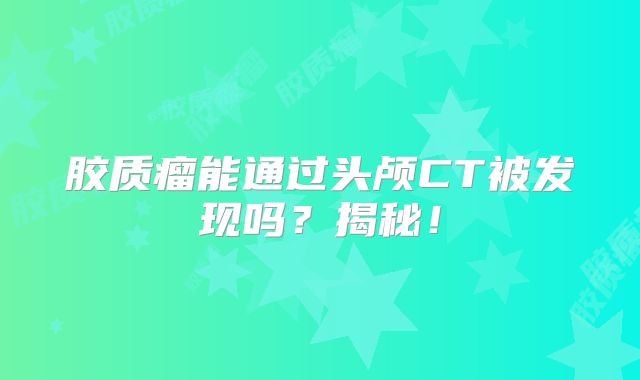 胶质瘤能通过头颅CT被发现吗？揭秘！