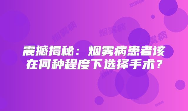 震撼揭秘：烟雾病患者该在何种程度下选择手术？