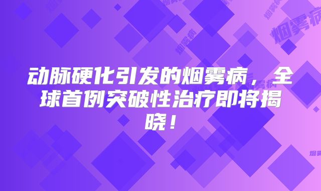 动脉硬化引发的烟雾病，全球首例突破性治疗即将揭晓！