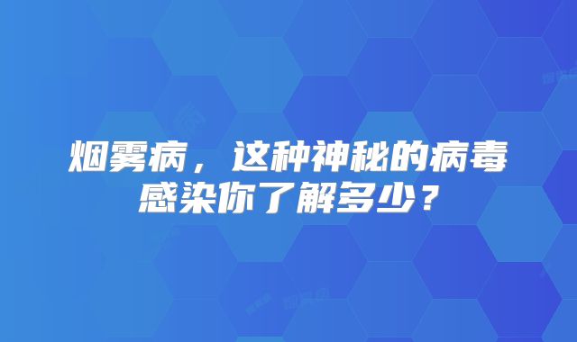 烟雾病，这种神秘的病毒感染你了解多少？