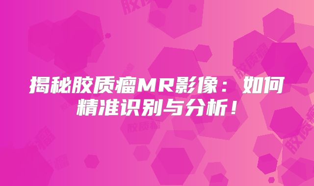 揭秘胶质瘤MR影像：如何精准识别与分析！