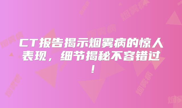 CT报告揭示烟雾病的惊人表现，细节揭秘不容错过！