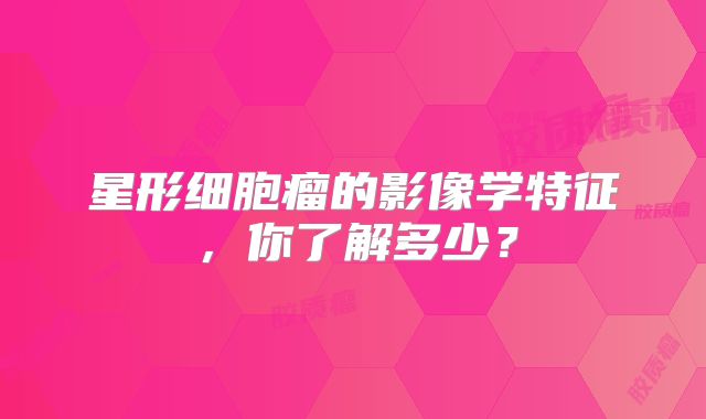 星形细胞瘤的影像学特征，你了解多少？