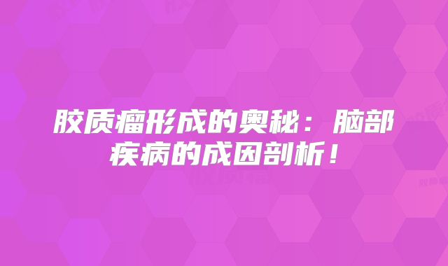 胶质瘤形成的奥秘：脑部疾病的成因剖析！