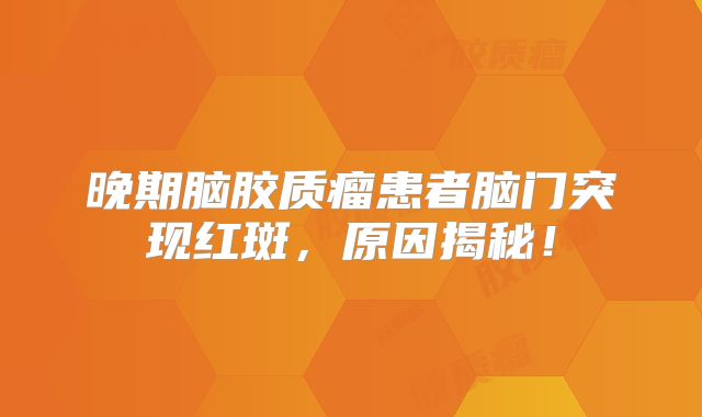 晚期脑胶质瘤患者脑门突现红斑，原因揭秘！