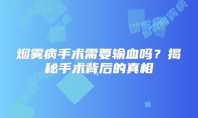 烟雾病手术需要输血吗？揭秘手术背后的真相