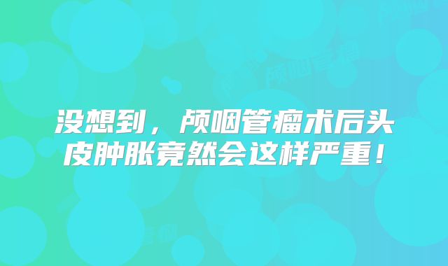 没想到，颅咽管瘤术后头皮肿胀竟然会这样严重！