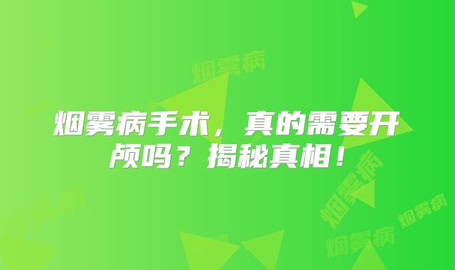 烟雾病手术，真的需要开颅吗？揭秘真相！