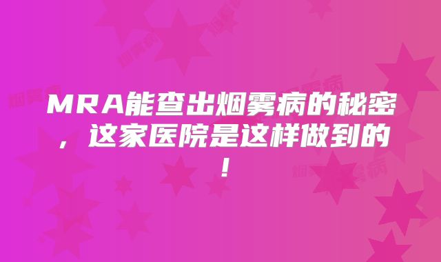 MRA能查出烟雾病的秘密，这家医院是这样做到的！