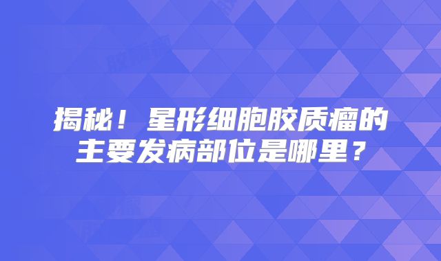揭秘！星形细胞胶质瘤的主要发病部位是哪里？