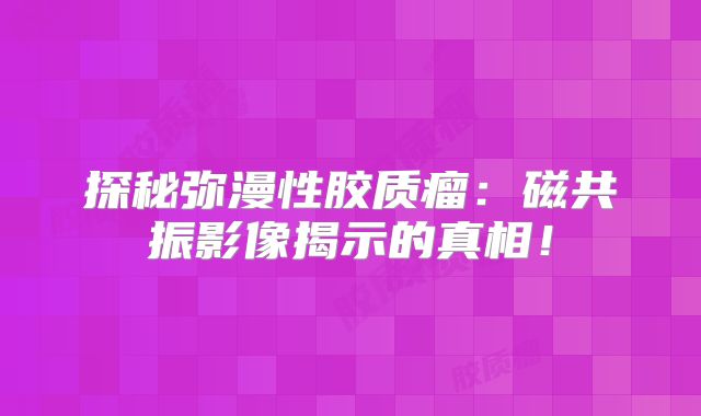 探秘弥漫性胶质瘤：磁共振影像揭示的真相！