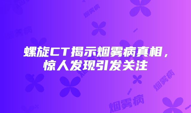 螺旋CT揭示烟雾病真相，惊人发现引发关注