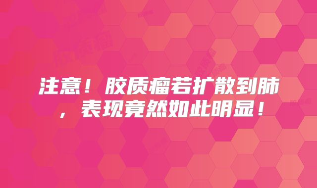 注意！胶质瘤若扩散到肺，表现竟然如此明显！