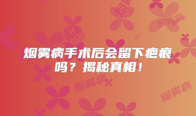 烟雾病手术后会留下疤痕吗？揭秘真相！