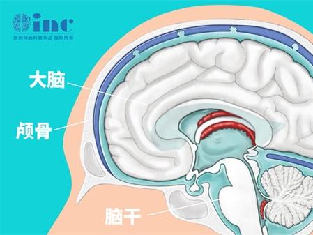 烟雾病治疗费用高企，患者该如何应对？