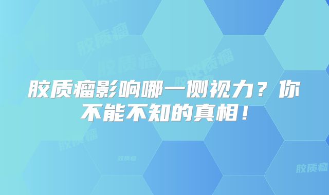 胶质瘤影响哪一侧视力？你不能不知的真相！