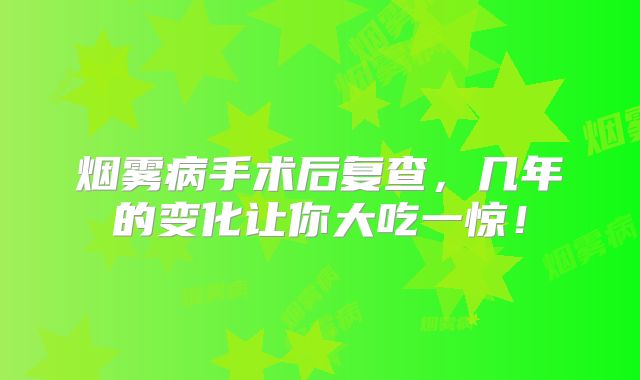 烟雾病手术后复查，几年的变化让你大吃一惊！
