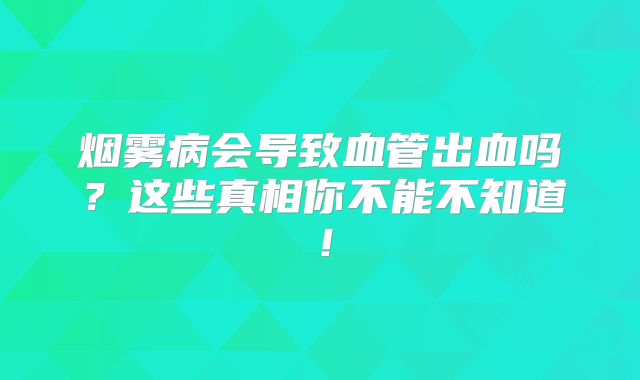 烟雾病会导致血管出血吗？这些真相你不能不知道！