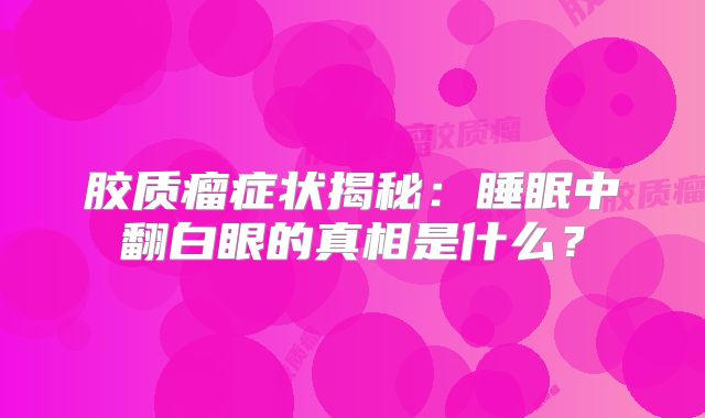 胶质瘤症状揭秘：睡眠中翻白眼的真相是什么？