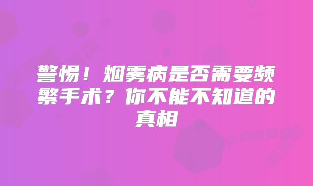 警惕！烟雾病是否需要频繁手术？你不能不知道的真相