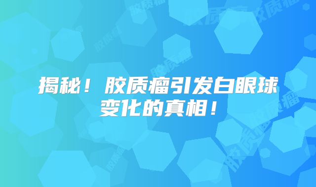 揭秘！胶质瘤引发白眼球变化的真相！