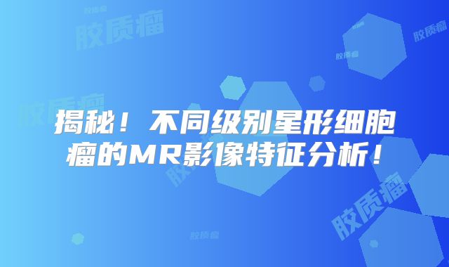 揭秘！不同级别星形细胞瘤的MR影像特征分析！