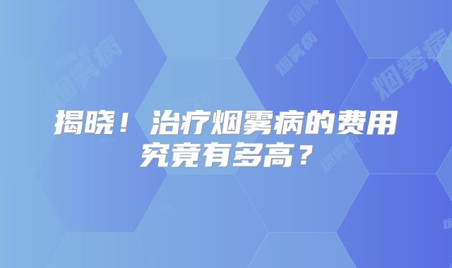 揭晓！治疗烟雾病的费用究竟有多高？