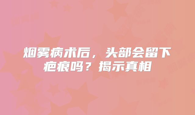 烟雾病术后，头部会留下疤痕吗？揭示真相