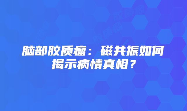 脑部胶质瘤：磁共振如何揭示病情真相？