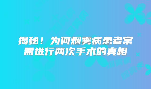 揭秘！为何烟雾病患者常需进行两次手术的真相