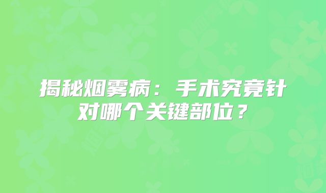 揭秘烟雾病：手术究竟针对哪个关键部位？