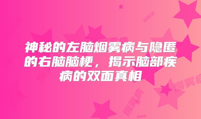神秘的左脑烟雾病与隐匿的右脑脑梗，揭示脑部疾病的双面真相