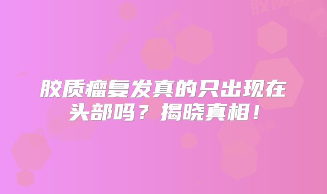 胶质瘤复发真的只出现在头部吗？揭晓真相！