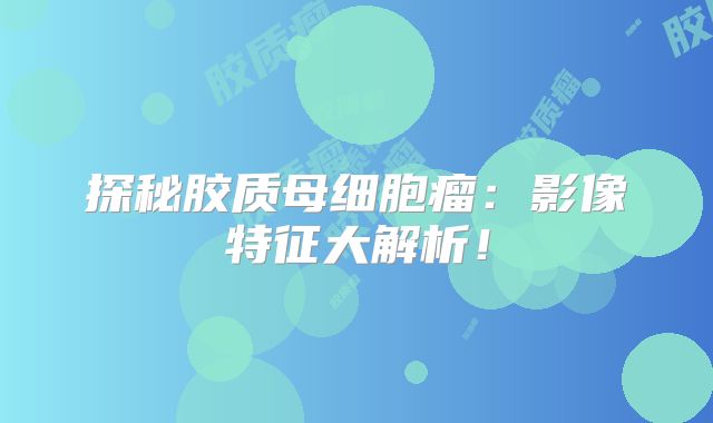 探秘胶质母细胞瘤：影像特征大解析！