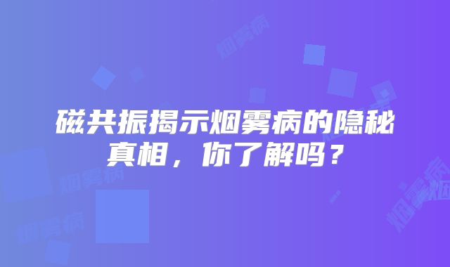 磁共振揭示烟雾病的隐秘真相，你了解吗？