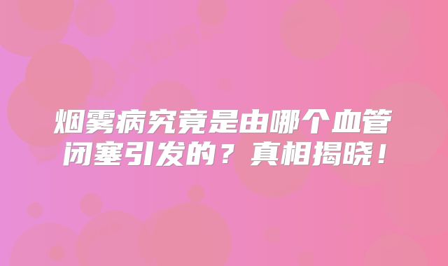 烟雾病究竟是由哪个血管闭塞引发的？真相揭晓！