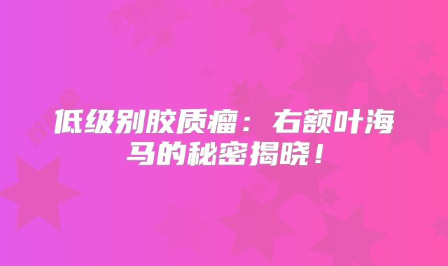 低级别胶质瘤：右额叶海马的秘密揭晓！