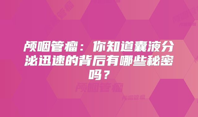 颅咽管瘤：你知道囊液分泌迅速的背后有哪些秘密吗？