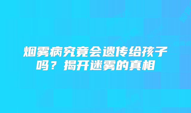 烟雾病究竟会遗传给孩子吗？揭开迷雾的真相