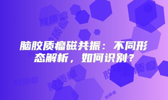 脑胶质瘤磁共振：不同形态解析，如何识别？