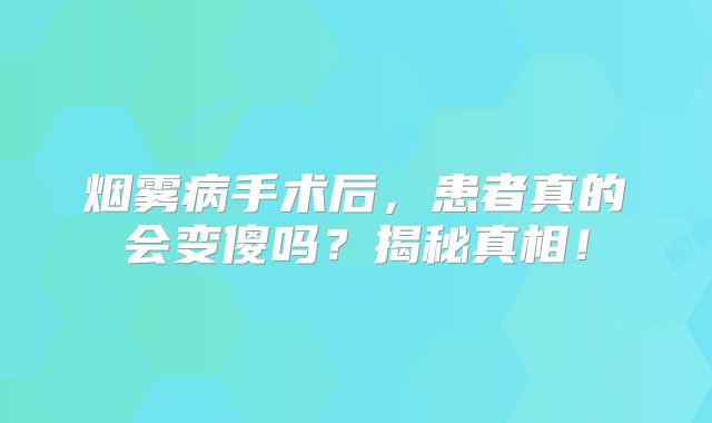 烟雾病手术后，患者真的会变傻吗？揭秘真相！