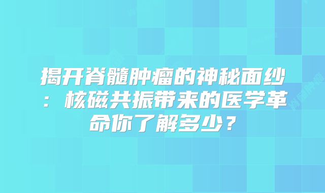 揭开脊髓肿瘤的神秘面纱：核磁共振带来的医学革命你了解多少？