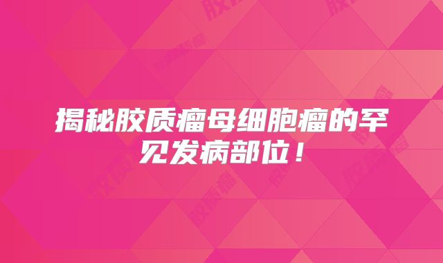 揭秘胶质瘤母细胞瘤的罕见发病部位！