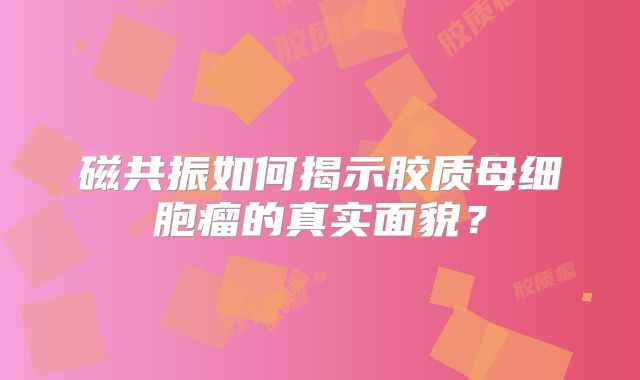 磁共振如何揭示胶质母细胞瘤的真实面貌？