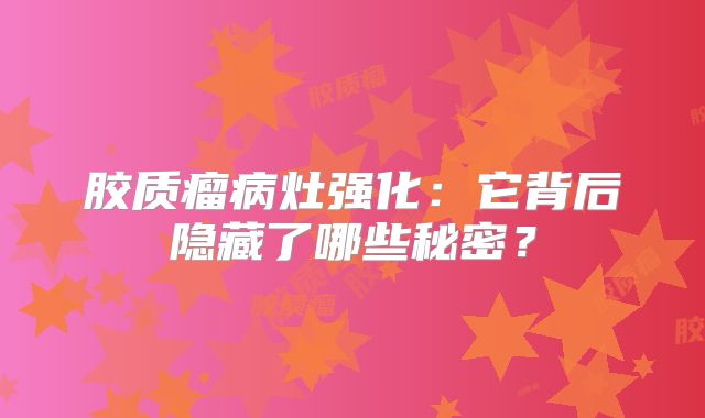 胶质瘤病灶强化：它背后隐藏了哪些秘密？