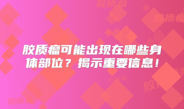 胶质瘤可能出现在哪些身体部位？揭示重要信息！