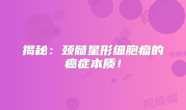 揭秘：颈髓星形细胞瘤的癌症本质！