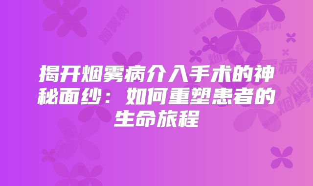 揭开烟雾病介入手术的神秘面纱：如何重塑患者的生命旅程
