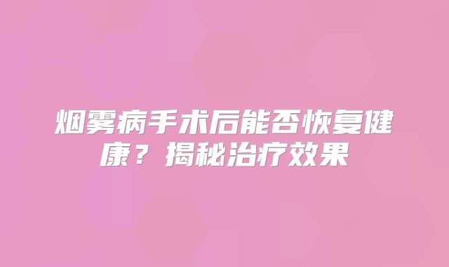 烟雾病手术后能否恢复健康？揭秘治疗效果